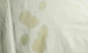 Macchie gialle sulla biancheria intima, forse dovute a sudore o a un lavaggio non perfetto.
