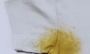 Macchie gialle di candeggina su capi bianchi, un disastro da rimuovere.