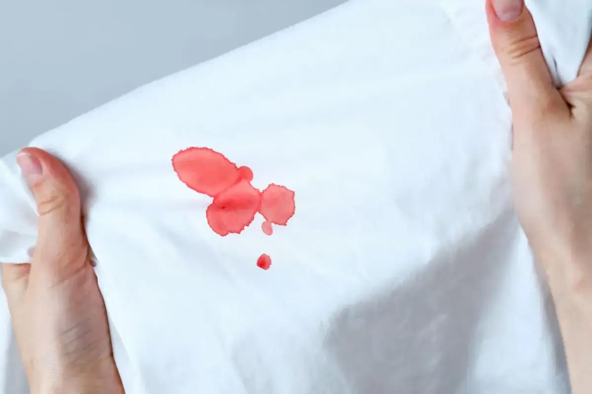 Macchie rosse su tessuto bianco, forse causate da acqua ossigenata.